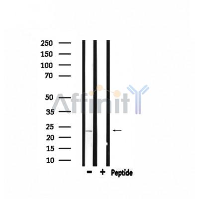 ARF4 Antibody - Western blot analysis of extracts from rat brain, using ARF4 Antibody.