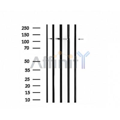 CLIP2 Antibody - Western blot analysis of extracts from HepG2, rat liver and rat brain, using CLIP2 Antibody.