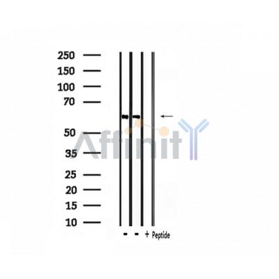 CLCC1 Antibody - Western blot analysis of extracts from HepG2 and rat heart, using CLCC1 Antibody.