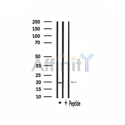INSL4 Antibody - Western blot analysis of extracts from rat heart, using INSL4 Antibody.