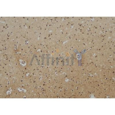 EPN3 Antibody - DF4046 at 1/100 staining Human brain tissue by IHC-P.