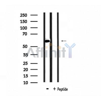 HNRPLL Antibody - Western blot analysis of extracts from mouse brain, using HNRPLL Antibody.