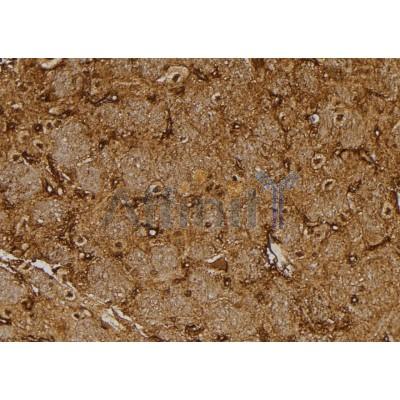 NUTF2 Antibody - DF4260 at 1/100 staining Rat brain tissue by IHC-P.