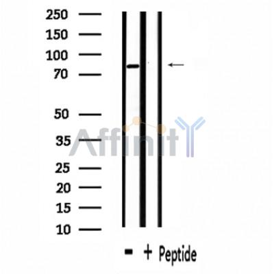 ZFYVE20 Antibody - Western blot analysis of extracts from rat heart , using ZFYVE20 Antibody.