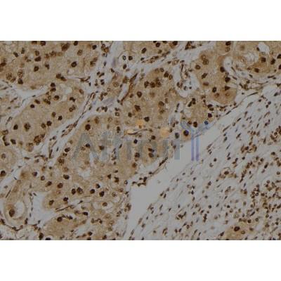 S100A3 Antibody - DF4354 at 1/100 staining Human kidney tissue by IHC-P.