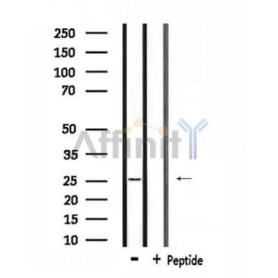 RAB38 Antibody - Western blot analysis of extracts from rat brain, using RAB38 Antibody.