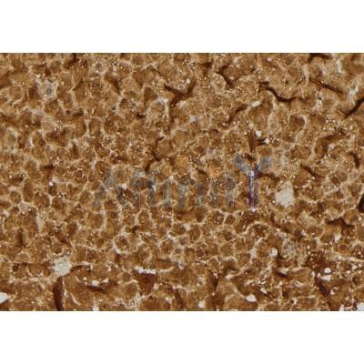 RHOB Antibody - DF4438 at 1/100 staining Rat liver tissue by IHC-P.