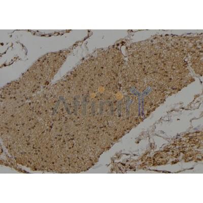 DVL3 Antibody - DF4455 at 1/100 staining Human gastric tissue by IHC-P.