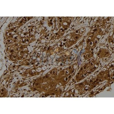 STK32C Antibody - DF4464 at 1/100 staining Human kidney tissue by IHC-P.