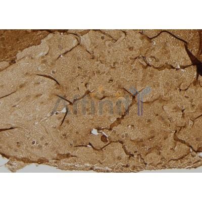 ULK3 Antibody - DF4479 at 1/100 staining Mouse brain tissue by IHC-P.