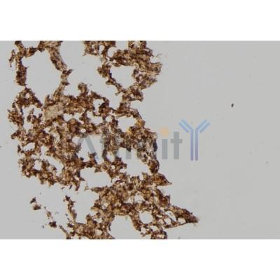 SH3GLB2 Antibody - DF4503 at 1/100 staining Mouse lung tissue by IHC-P.