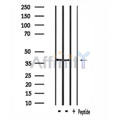 RNF130 Antibody - Western blot analysis of extracts from 293 and rat brain, using RNF130 Antibody.