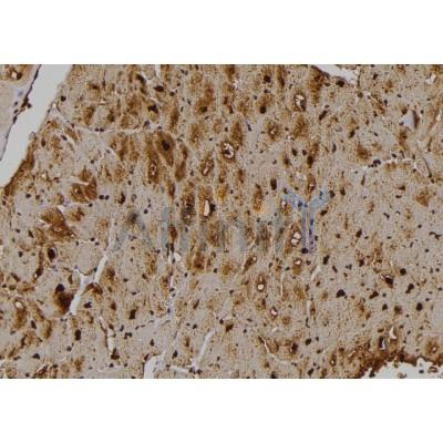 STK33 Antibody - DF4791 at 1/100 staining Human heart tissue by IHC-P.