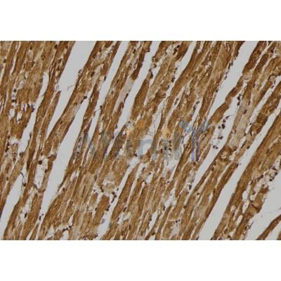 GPR137C Antibody - DF4933 at 1/100 staining Mouse heart tissue by IHC-P.