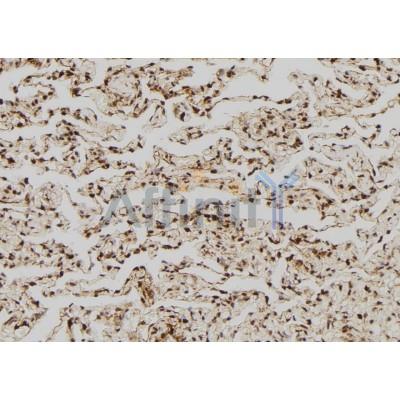 Fas Ligand Antibody - AF5333 at 1/100 staining Human lung tissue by IHC-P.