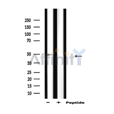 c-Fos Antibody | Affinity Biosciences LTD|亲科生物官网