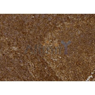 iNOS Antibody - AF5369 at 1/100 staining Mouse spleen tissue by IHC-P.