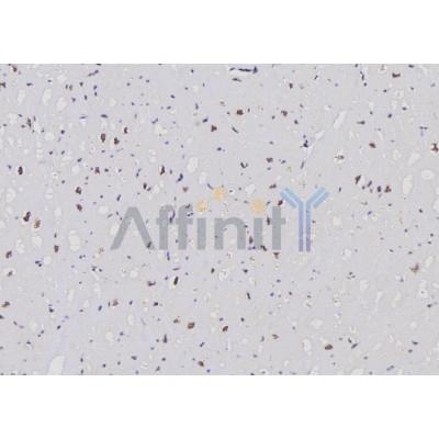 Ki67 Antibody - AF5498 at 1/100 staining Human heart tissue by IHC-P.