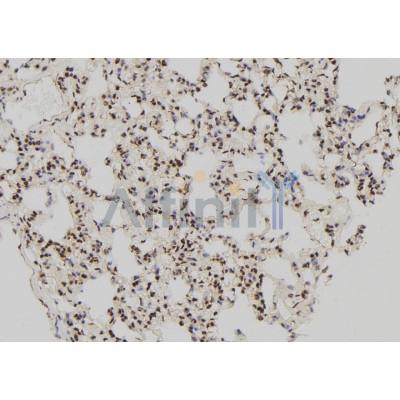 ATF4 Antibody - DF6008 at 1/100 staining Rat lung tissue by IHC-P.