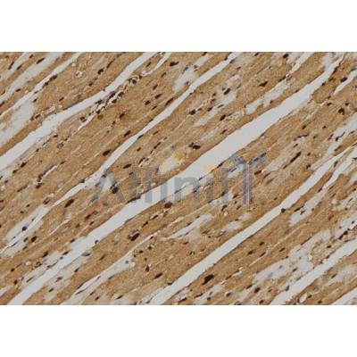 PKC alpha Antibody - DF6070 at 1/100 staining Mouse heart tissue by IHC-P.