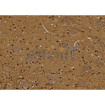 TCL1A Antibody - DF6112 at 1/100 staining Rat brain tissue by IHC-P.