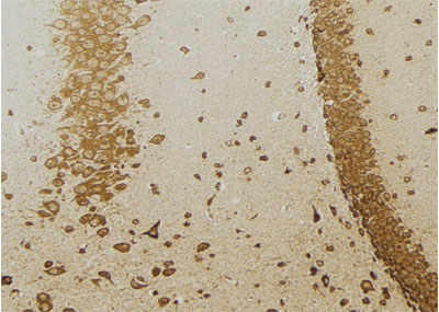 GAD2 Antibody - DF6153 at 1/100 staining  mouse brain tissue by IHC-P.