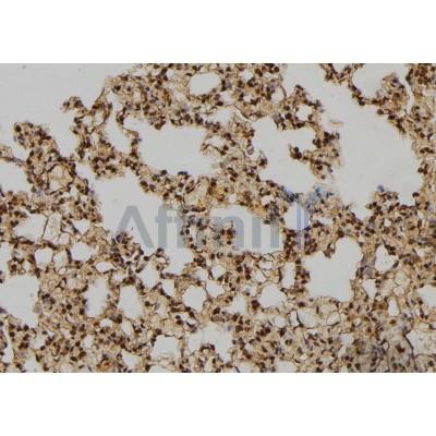 RAN Antibody - DF6158 at 1/100 staining Rat lung tissue by IHC-P.