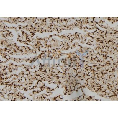 NCK1 Antibody - DF6181 at 1/100 staining Human lung tissue by IHC-P.