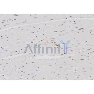 IRF4 Antibody - DF6198 at 1/100 staining Rat heart tissue by IHC-P.