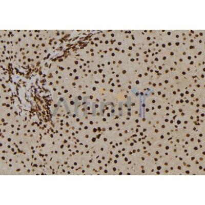 Beta Arrestin 2 Antibody - DF6305 at 1/100 staining Rat liver tissue by IHC-P.
