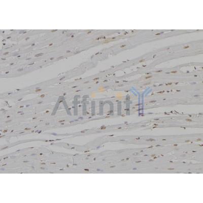 UGDH Antibody - DF6342 at 1/100 staining Rat heart tissue by IHC-P.