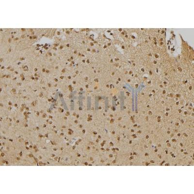 PTPN22 Antibody - DF6407 at 1/100 staining Mouse brain tissue by IHC-P.