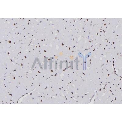 APOBEC3G Antibody - DF6418 at 1/100 staining Human heart tissue by IHC-P.