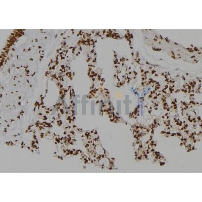 CSNK2A2 Antibody - DF6504 at 1/100 staining Rat lung tissue by IHC-P.