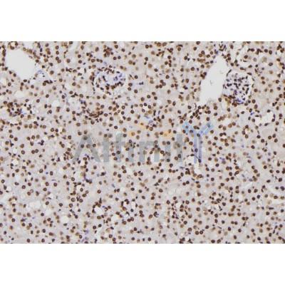 XPA Antibody - DF6513 at 1/100 staining Mouse kidney tissue by IHC-P.