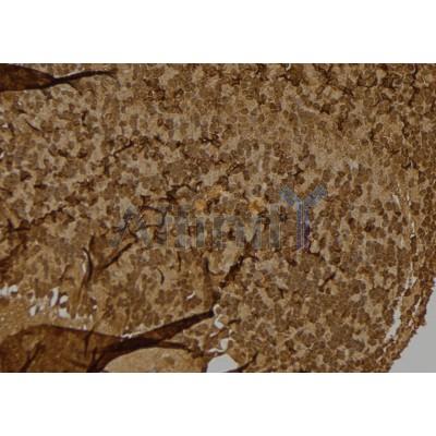 S100A4 Antibody - DF6516 at 1/100 staining Mouse brain tissue by IHC-P.