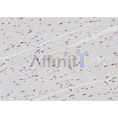 HNRNPK Antibody - DF6563 at 1/100 staining Rat heart tissue by IHC-P.