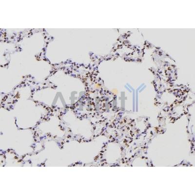 POLR2E Antibody - DF6595 at 1/100 staining Rat lung tissue by IHC-P.