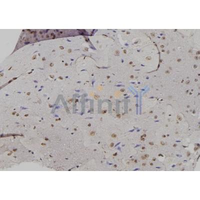 GADD45A Antibody - DF6622 at 1/100 staining Mouse brain tissue by IHC-P.