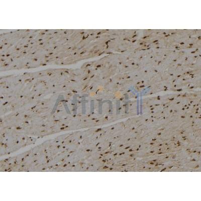 Peroxiredoxin 1 Antibody - DF6652 at 1/100 staining Rat heart tissue by IHC-P.