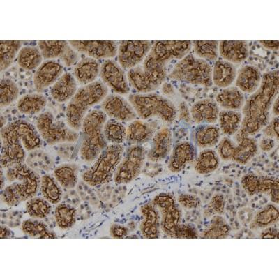 IKZF1 Antibody - DF6659 at 1/100 staining Rat kidney tissue by IHC-P.