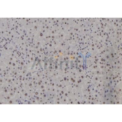 ATF3 Antibody - DF6660 at 1/100 staining Mouse liver tissue by IHC-P.