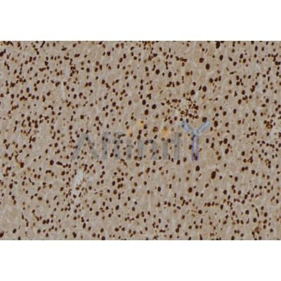 U2AF2 Antibody - DF6704 at 1/100 staining Rat liver tissue by IHC-P.