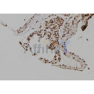 MCM6 Antibody - DF6716 at 1/100 staining Rat lung tissue by IHC-P.