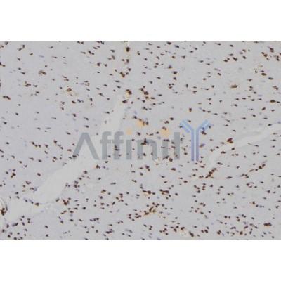 HIST2H2BE Antibody - DF6718 at 1/100 staining Human gastric tissue by IHC-P.