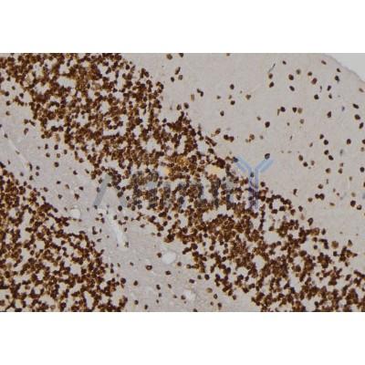 MVP Antibody - DF6732 at 1/100 staining Rat brain tissue by IHC-P.