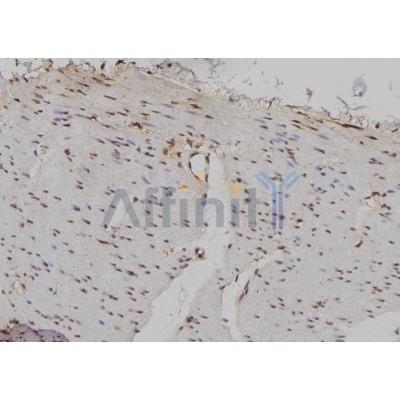 IPO5 Antibody - DF6735 at 1/100 staining Human gastric tissue by IHC-P.