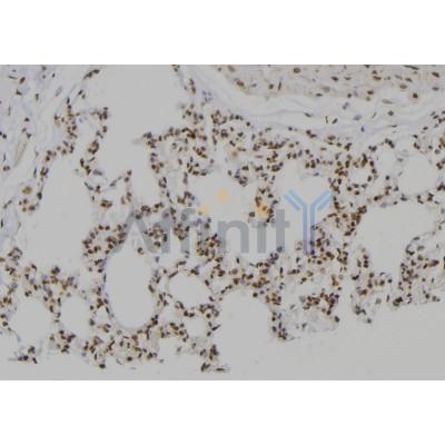 PSMC2 Antibody - DF6736 at 1/100 staining Rat lung tissue by IHC-P.