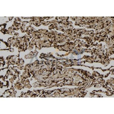 DST Antibody - DF6752 at 1/100 staining Human lung tissue by IHC-P.