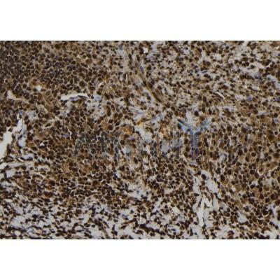 EIF5A1 Antibody - DF6754 at 1/100 staining Human spleen tissue by IHC-P.